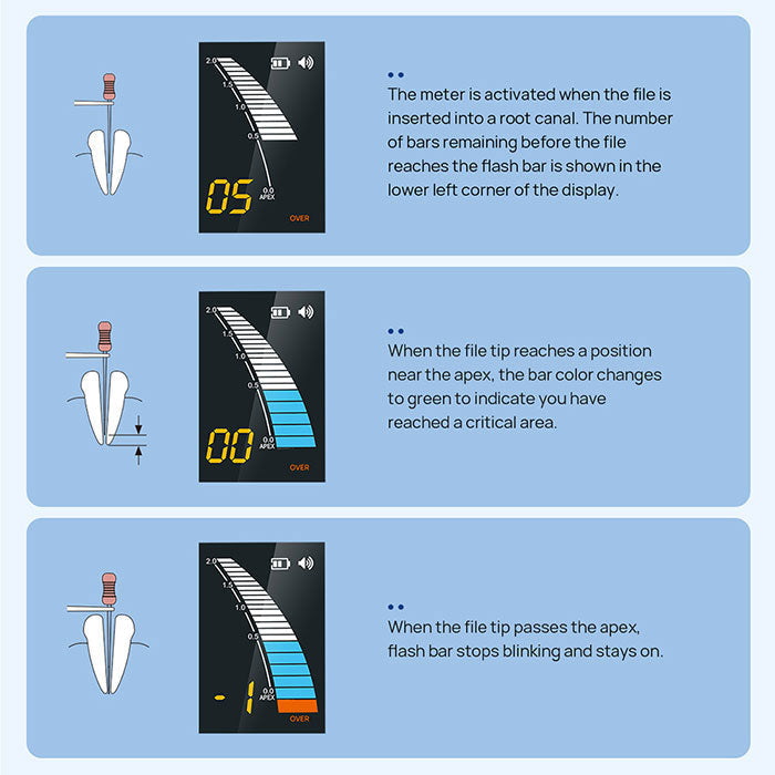 Dental Endo Apex Locator Root Canal Measurement Tool - azdentall.com