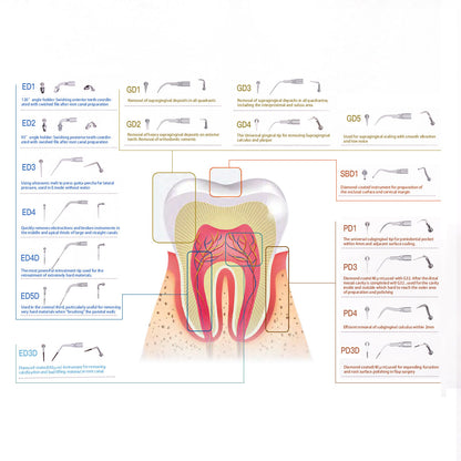 AZDENT Ultrasonic Scaler Endodontic Tips